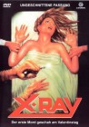 DVD X-Ray - Der erste Mord geschah am Valentinstag 